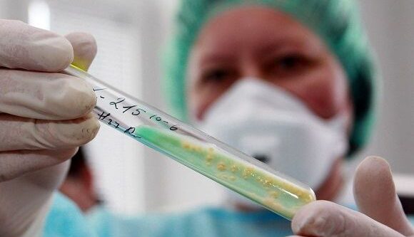 „Apie sveikatą ir gyvenimą“ – tuberkuliozė šiandien ne istorija