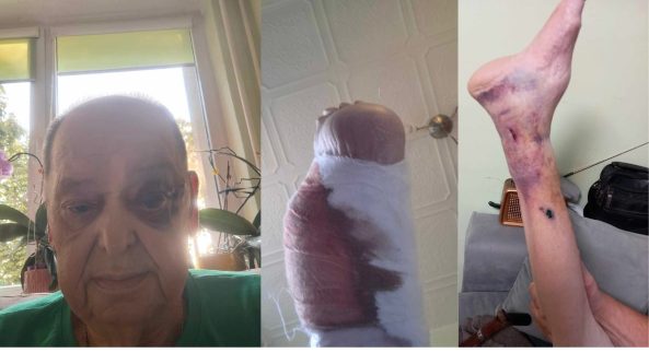 Neįgalus alytiškis skundžiasi priimamojo gydytojų aplaidumu: „Net neapžiūrėjo…“