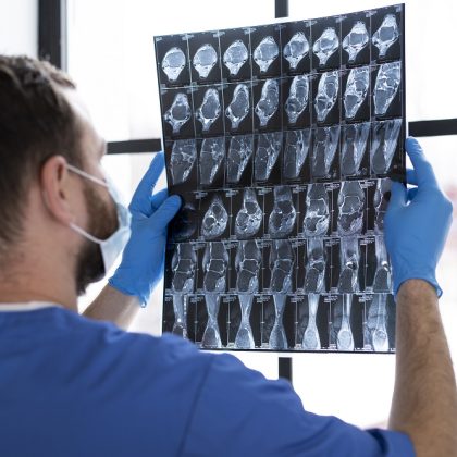 Nematomi sveikatos signalai? Mūsų radiologija padės juos pamatyti